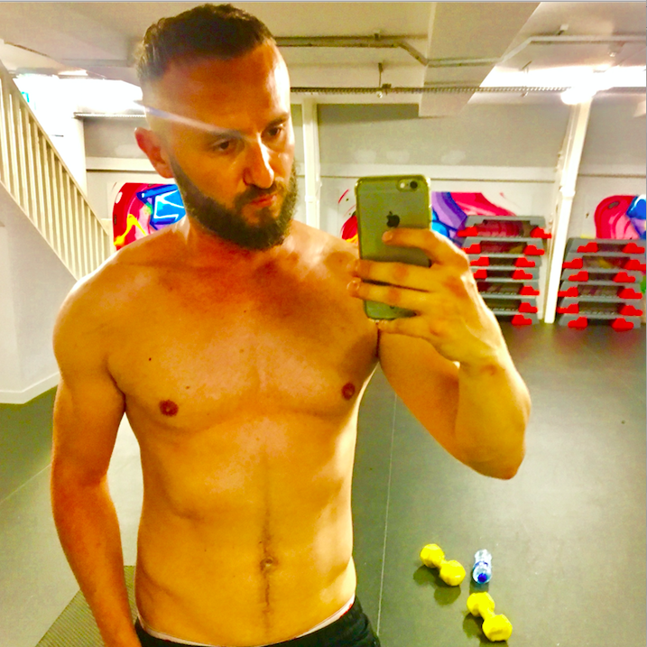 INTERMITTENT FASTING